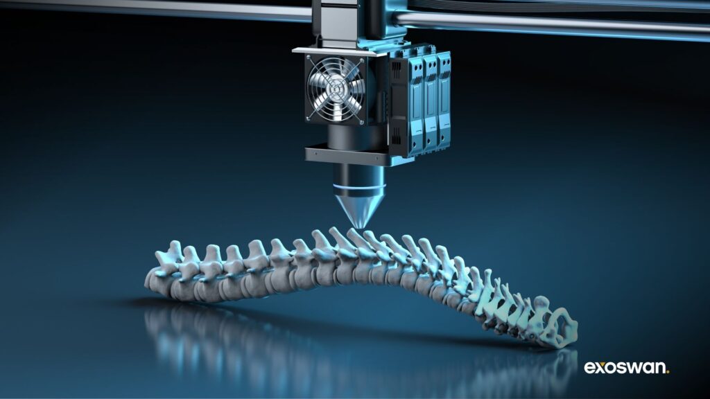 3D bioprinting a bone structure